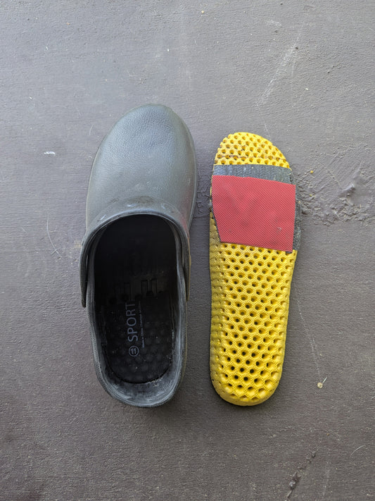 Plantar plates and gait by adarian barr